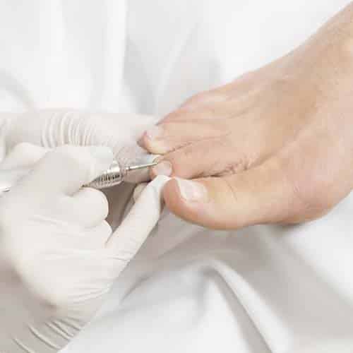 PEDICURE_podologie_loic_bataille